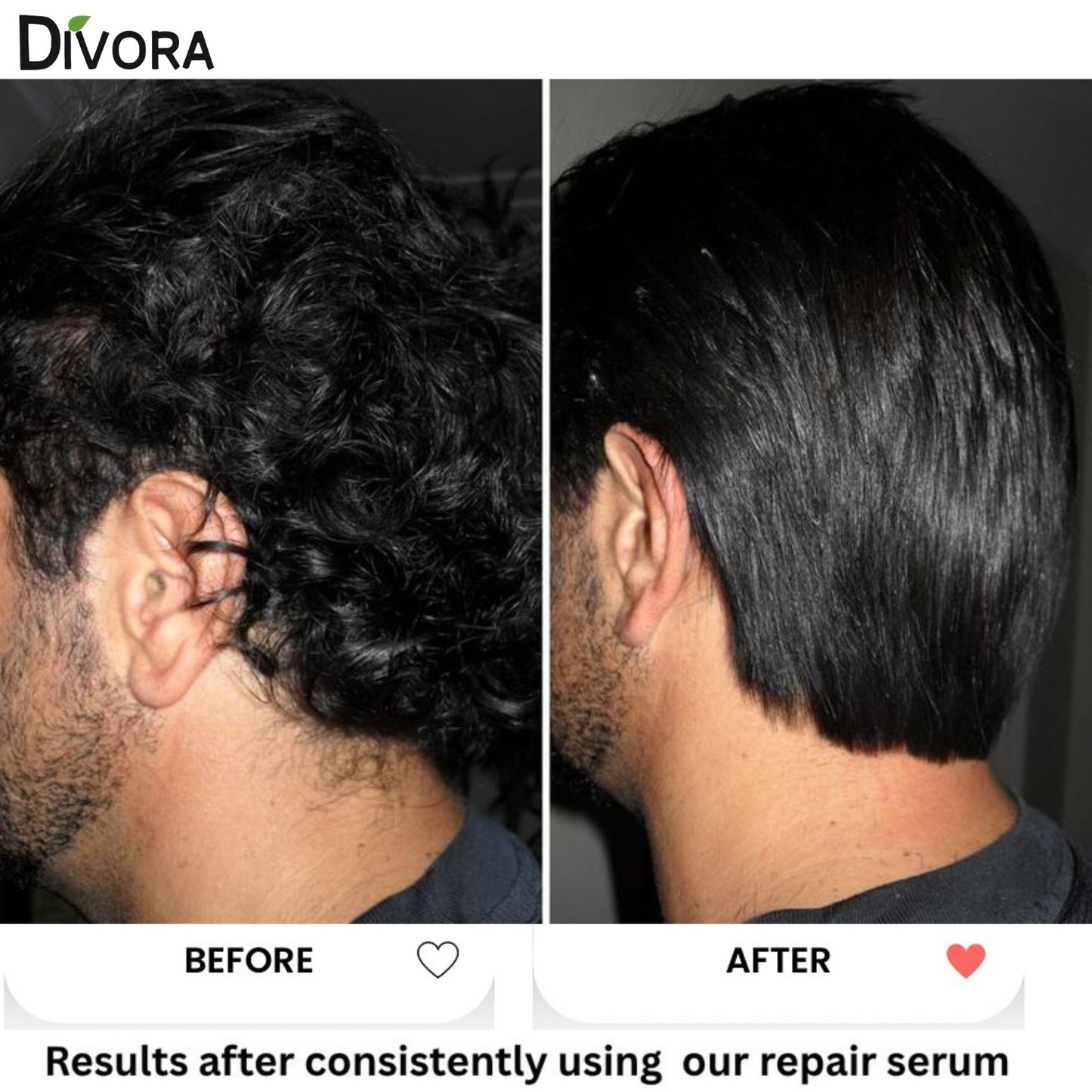 Intense | Hair Repair Serum  (5 IN 1)
